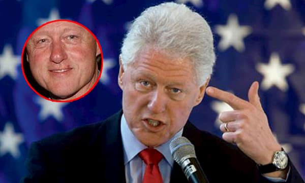 Bill Clinton with cold sore, celebrities with cold sores