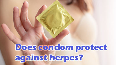 Does condom protect against herpes?