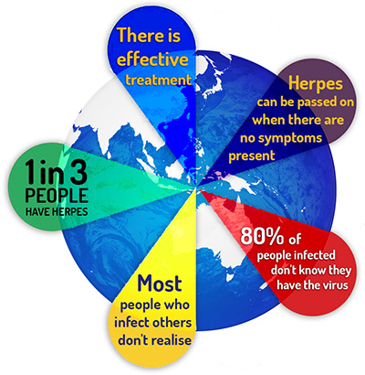 herpes,key facts