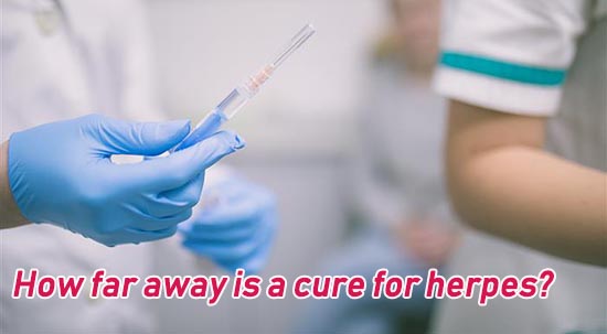 how far away is a cure for herpes?