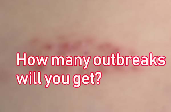 How many outbreaks will you get?