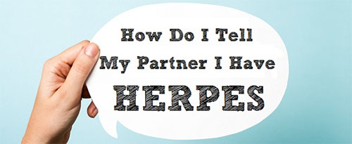 how to tell your partner about you have herpes