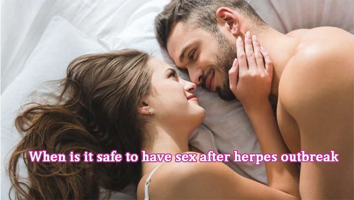 When is it safe to have sex after herpes outbreak, How long after herpes outbreak is it safe